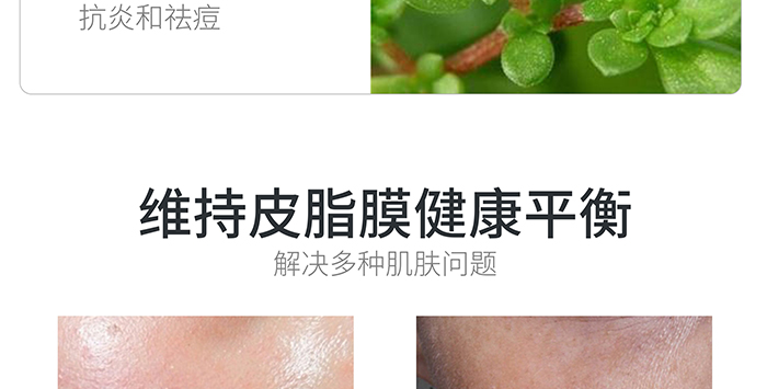 高地保濕修護(hù)霜 高地保濕修護(hù)霜